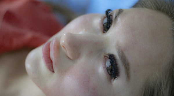 4 Reasons Why Radiofrequency Microneedling Is So Effective For Skin Conditions